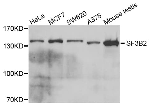 Polyclonal Rabbit anti-Human SF3B2 Antibody (IHC, IF, WB)