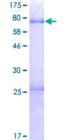 Human PROCA1 Protein (Recombinant GST)