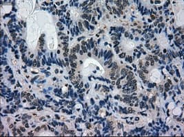 MAPK1 / ERK2 Antibody (clone OTI9H1)