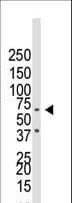 Polyclonal Rabbit anti-Human ALK-6 / BMPR1B Antibody (aa1-30, WB)
