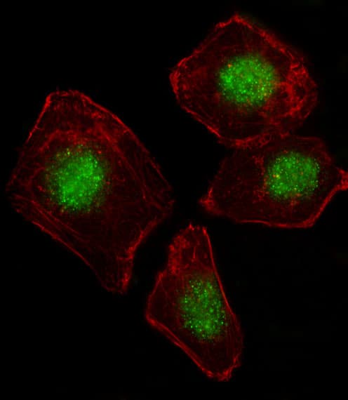 ZNF187 Antibody (aa3-31)