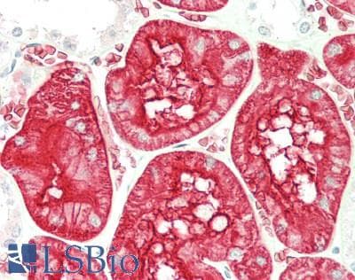 IHC-plus™ AQP1 / Aquaporin 1 Antibody (clone 10C11)