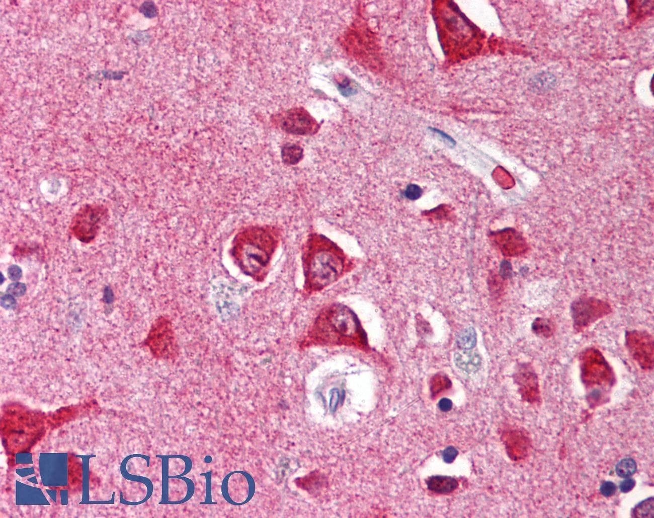 IHC-plus™ Polyclonal Rabbit anti-Human SCO1 Antibody (IHC, IF, WB)