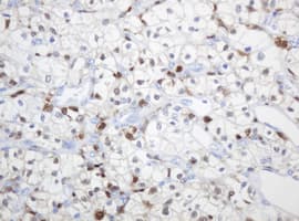 TP / Thymidine Phosphorylase Antibody (aa311-482, clone OTI1E7, Carrier-free)