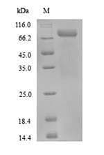 Human PADI3 Protein (Recombinant 6His, N-terminus)