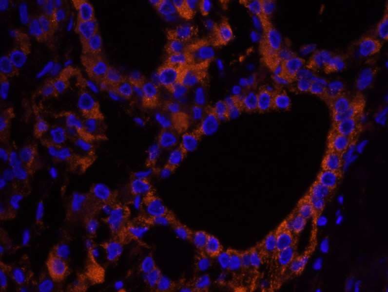 NF2 / Merlin Antibody (aa550-C-term)
