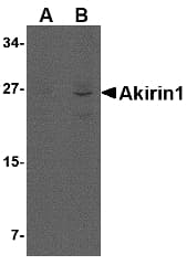 IHC-plus™ AKIRIN1 Antibody