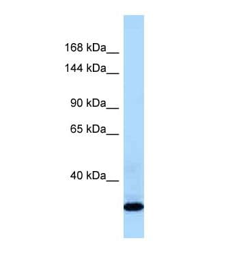 COL21A1 / Collagen XXI Antibody (aa82-131)