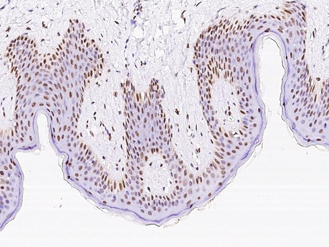 NR2C1 Antibody