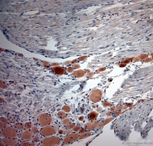 CACNA2D1 Antibody (aa600-650)