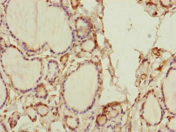 SPICE1 / CCDC52 Antibody