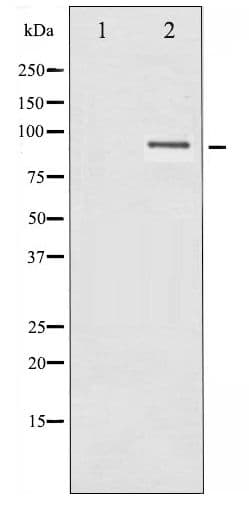 Polyclonal Rabbit anti-Human IKBKB / IKK2 / IKK Beta Antibody (IHC, WB)