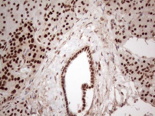 IRS1 Antibody (aa1-280, clone OTI3G10)