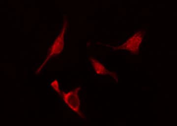 ARL2BP / BART Antibody