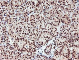 RFXANK Antibody (clone OTI2F12)