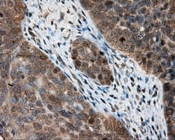 Monoclonal Mouse anti-Human PTPRE / PTP Epsilon Antibody (clone OTI4B2, IHC, IF, WB)