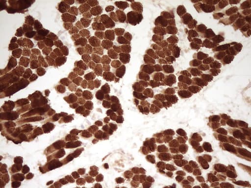TNNT2 / CTNT Antibody (clone OTI3C6, Carrier-free)