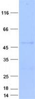 Human BAMBI Protein (Recombinant GST, N-terminus + His, C-terminus)