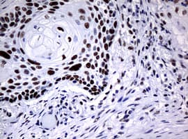 NBN / Nibrin Antibody (clone OTI2E9)