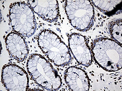 DDX39B / UAP56 Antibody (aa319-428, clone OTI2F11)