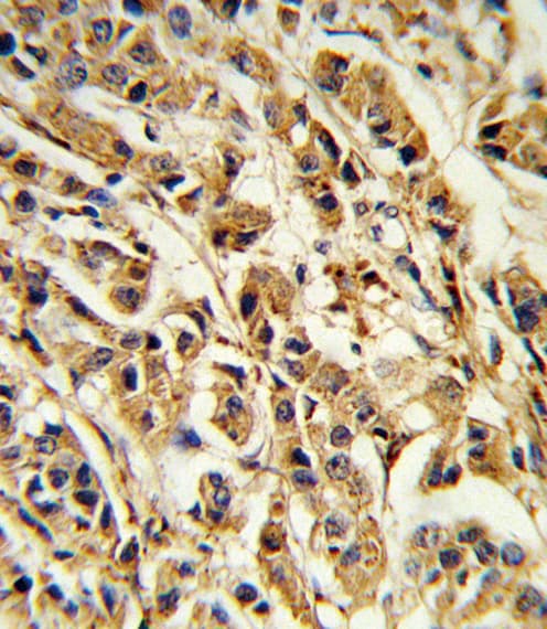 SREBF1 / SREBP-1 Antibody (aa349-378)