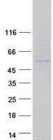 Human RGS11 Protein (Recombinant Myc-DDK (Flag))