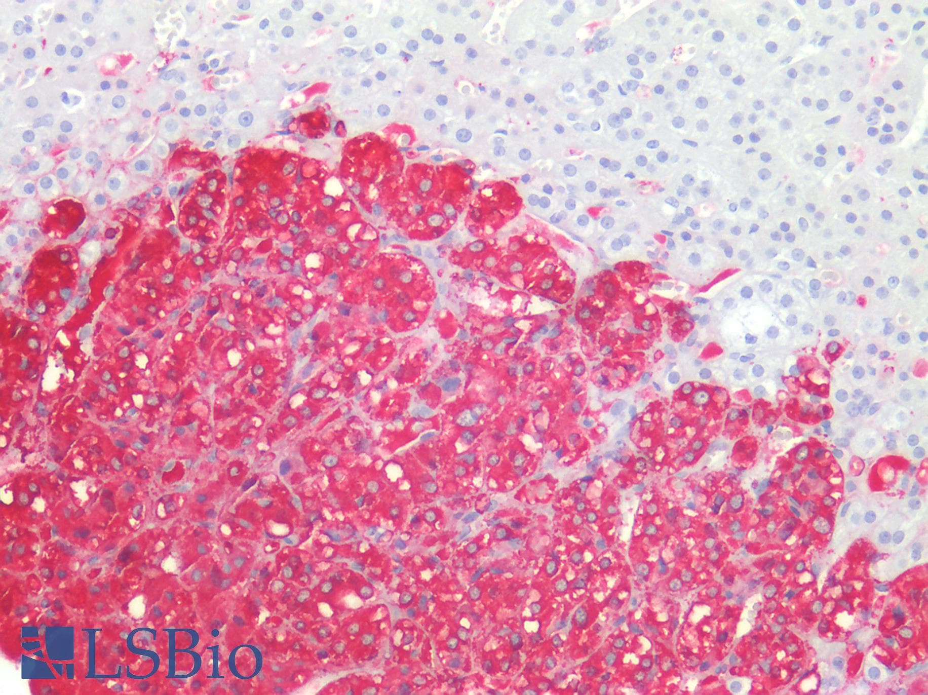 PathPlus™ TH / Tyrosine Hydroxylase Antibody (clone OTI3H3)