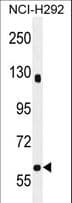 Polyclonal Rabbit anti-Human SPATA5L1 Antibody (aa585-613, WB)
