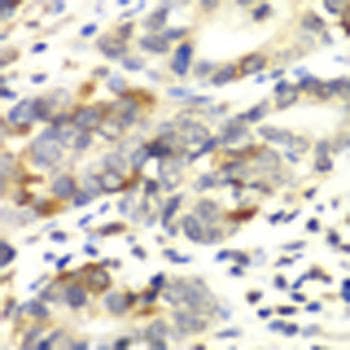 APLP1 / APLP-1 Antibody