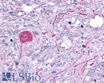 PathPlus™ HTR6 / 5-HT6 Receptor Antibody (C-Terminus)