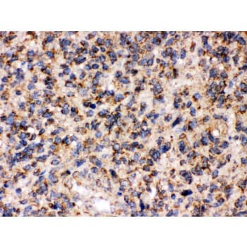 APBB1 / FE65 Antibody (aa21-56)
