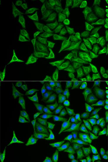 KRT20 / CK20 / Cytokeratin 20 Antibody