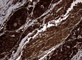 NME1 / NM23 Antibody (clone OTI1H4)