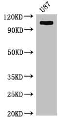 HK2 / Hexokinase 2 Antibody