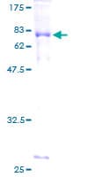 Human ATF4 Protein (Recombinant GST)