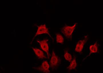 Polyclonal Rabbit anti-Human TP53 / p53 Antibody (IHC, IF, WB)