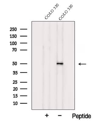 TXNDC5 / ERP46 Antibody