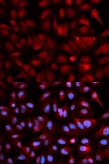 IHC-plus™ PSMB5 Antibody