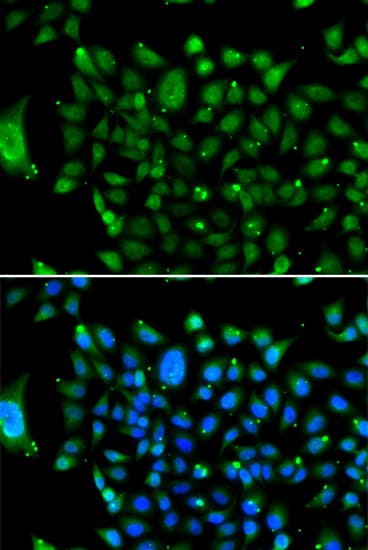 Polyclonal Rabbit anti-Human N-CoR / NCOR1 Antibody (IHC, IF, WB)