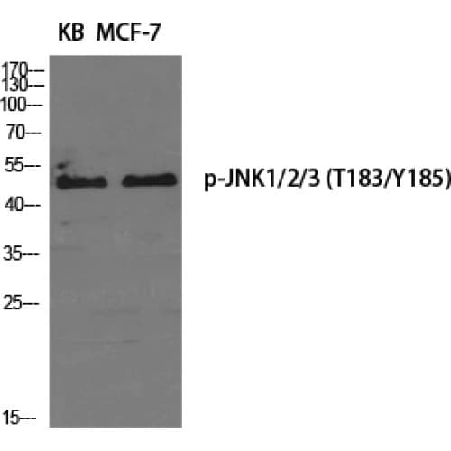 JNK1+2+3 Antibody (120-200 aa)