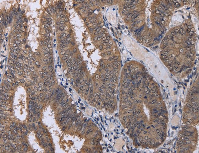 Polyclonal Rabbit anti-Human CUL3 / Cullin 3 Antibody (IHC, WB)