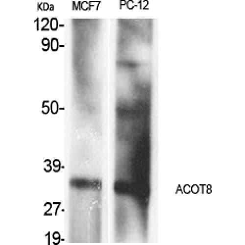 ACOT8 Antibody (100-180 aa, Internal)