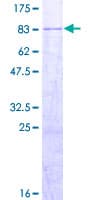 Human FBX33 / FBXO33 Protein (Recombinant GST)