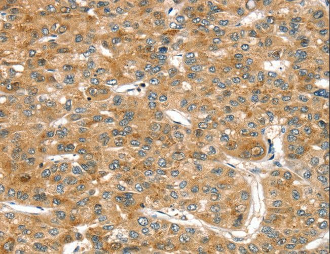 RASSF9 / P-CIP1 Antibody
