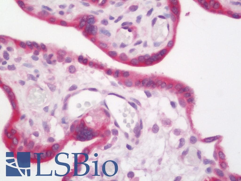 IHC-plus™ MAGEA3 Antibody (clone 1G9)