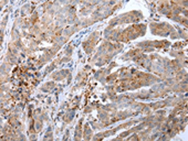 CALB2 / Calretinin Antibody