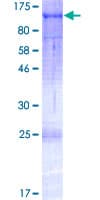 Human NAP1 / TAB3 Protein (Recombinant GST)