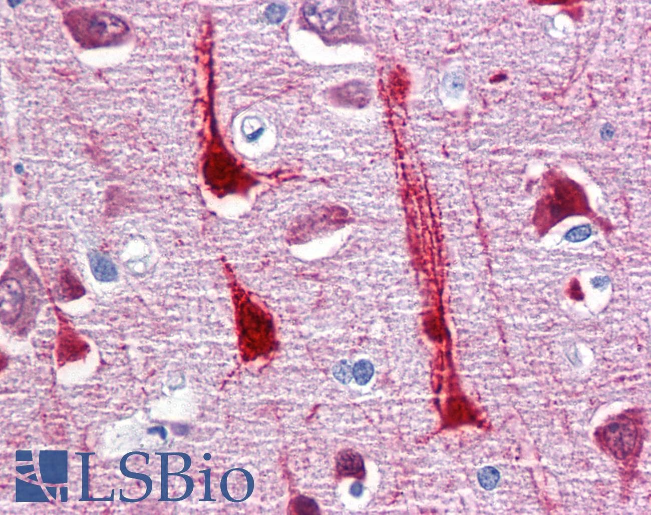 IHC-plus™ CRYM Antibody (clone 6B3)