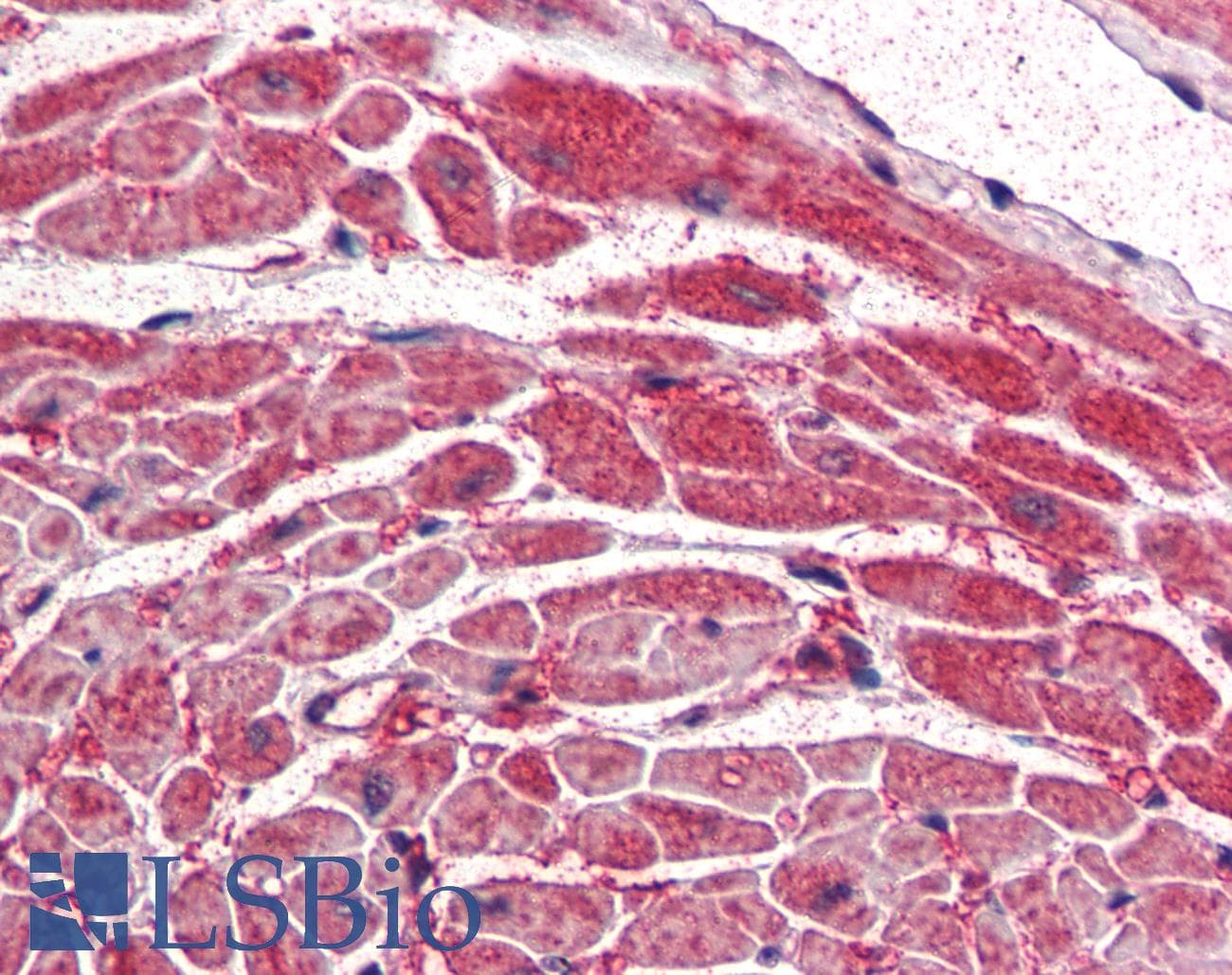 PathPlus™ Polyclonal Goat anti-Human PIK3CA / PI3K Alpha Antibody (aa800-1000, IHC)