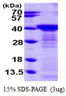 Human ARG1 / Arginase 1 Protein (Recombinant His)